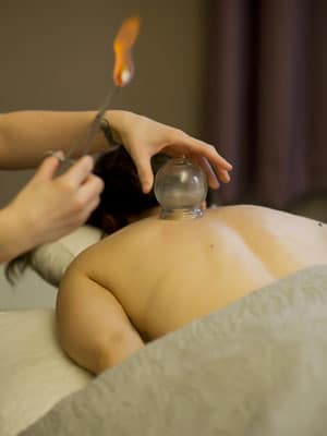 Chiropractic Brookfield WI Fire Cupping